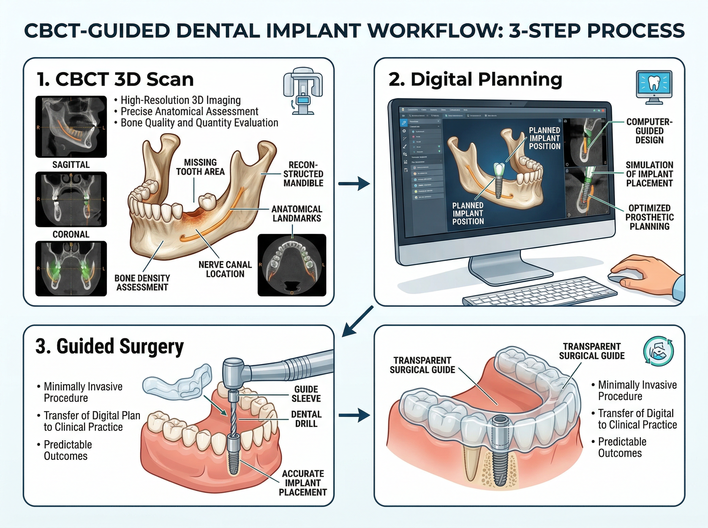 圖二:CBCT導航植牙工作流程